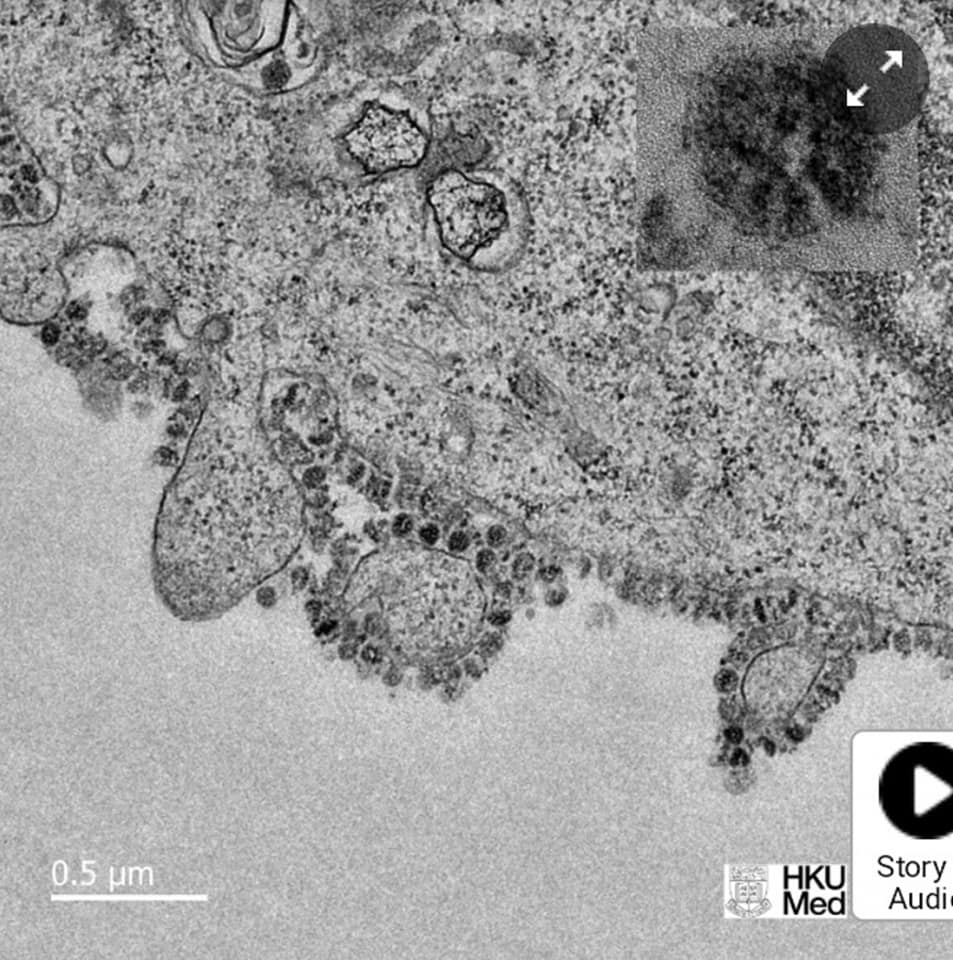 , Come il coronavirus SARS-CoV-2 entra nelle cellule